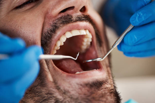 Best Emergency Dental Care for Broken or Chipped Teeth in Bethany, OK